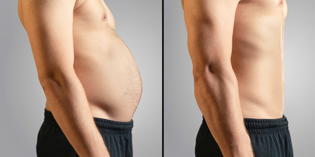 Før og efter - overvægtig og tynd. Stofskiftet har betydning for vægt.